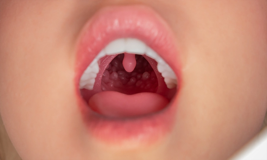 fanreal-ROS_Movable_Jaw_04